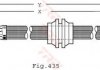 Тормозной шланг TRW TRW PHD479 (фото 1)