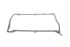 Комплект ланцюга ГРМ Audi A4 1.8 95-00 HEPU 21-0304 (фото 4)