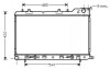 Радіатор охолодження SUBARU FORESTER (2002) 2.0 STARLINE SU2054 (фото 1)